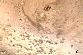 Attēlu rezultāti vaicājumam “Didymium serpula young”