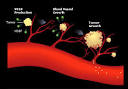 Genentech: Research: Angiogenesis