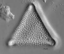 Attēlu rezultāti vaicājumam “Arcyria globosa young”