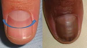 Image result for lunula nail