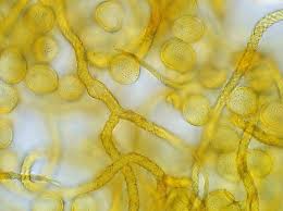 Attēlu rezultāti vaicājumam “Diderma chondrioderma spores”