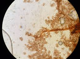 Attēlu rezultāti vaicājumam “Reticularia jurana spores”