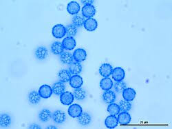 Attēlu rezultāti vaicājumam “Lycogala fuscoolearium spores”