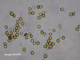 Attēlu rezultāti vaicājumam “Chaenotheca trichialis”