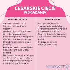 Image result for cesarskie