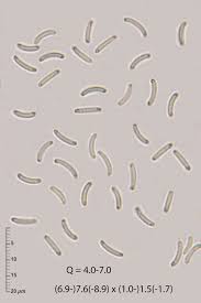 Attēlu rezultāti vaicājumam “Diatrype disciformis”