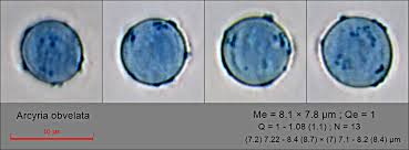 Attēlu rezultāti vaicājumam “Heterotrichia obvelata (syn. Arcyria obvelata) spores”
