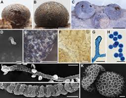 Attēlu rezultāti vaicājumam “Lycogala succineum”
