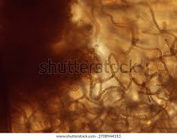 Attēlu rezultāti vaicājumam “Arcyria minuta”