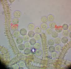 Attēlu rezultāti vaicājumam “Heterotrichia obvelata (syn. Arcyria obvelata) spores”