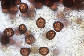 Attēlu rezultāti vaicājumam “Badhamia capsulifera macro”