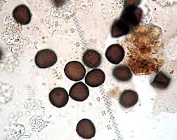 Attēlu rezultāti vaicājumam “Physarum cinereum spores”