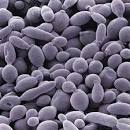 Is Dry Yeast Alive or Dead ?...or inbetween ? (and other yeats ... 