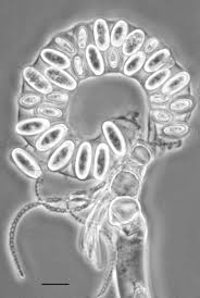 Attēlu rezultāti vaicājumam “Ophiostoma polyporicola”