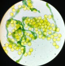 Attēlu rezultāti vaicājumam “Perichaena corticalis spores”