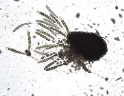 Attēlu rezultāti vaicājumam “Diachea subsessilis spores”