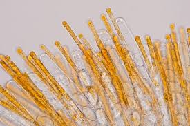 Attēlu rezultāti vaicājumam “Cheilymenia stercorea”