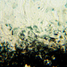 Attēlu rezultāti vaicājumam “Megalaria grossa”