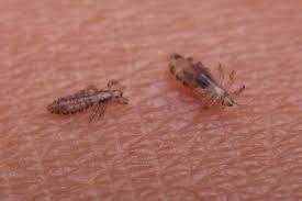 Attēlu rezultāti vaicājumam “Pediculus humanus capitis”