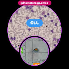 Attēlu rezultāti vaicājumam “Pseudobryum cinclidioides cells”