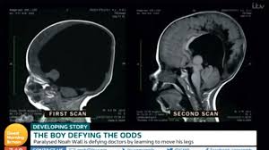 Image result for no brain