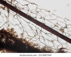 Attēlu rezultāti vaicājumam “Symphytocarpus flaccidus spores”