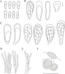 Attēlu rezultāti vaicājumam “Arthonia byssacea”