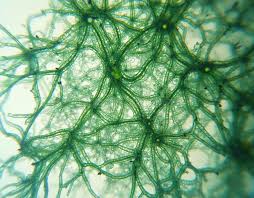 Attēlu rezultāti vaicājumam “Nostoc pruniforme cells”