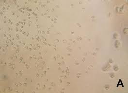 Attēlu rezultāti vaicājumam “Hemitrichia serpula spores”