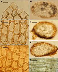 Attēlu rezultāti vaicājumam “Gymnocolea inflata”