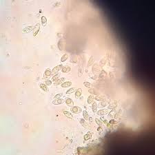 Attēlu rezultāti vaicājumam “Verrucaria hydrela”