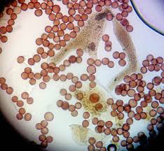 Attēlu rezultāti vaicājumam “Licea chelonoides spores”