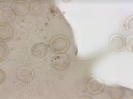 Attēlu rezultāti vaicājumam “Ophiotheca chrysosperma spores”