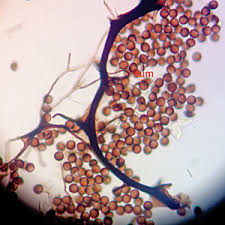Attēlu rezultāti vaicājumam “Lycogala cf. oleocrystalliferum”