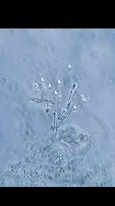 Attēlu rezultāti vaicājumam “Didymium clavus spores”