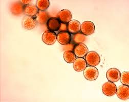 Attēlu rezultāti vaicājumam “Ochropsora ariae spores”