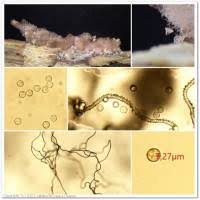 Attēlu rezultāti vaicājumam “Arcyria incarnata”