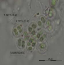 Attēlu rezultāti vaicājumam “Gloeocapsa rupestris”
