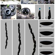 Attēlu rezultāti vaicājumam “Rosellinia desmazieri spores”