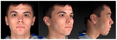 Image result for Co de Crista Chins