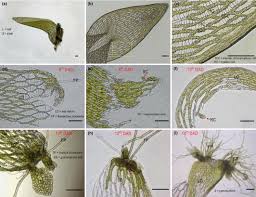 Attēlu rezultāti vaicājumam “Sphagnum squarrosum sporophyte”