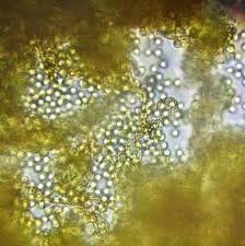 Attēlu rezultāti vaicājumam “Trichia varia spores”