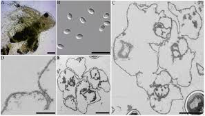 Attēlu rezultāti vaicājumam “Comatricha elegans var. microspora spores”