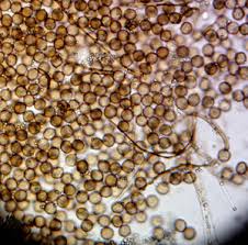 Attēlu rezultāti vaicājumam “Diderma cingulatum”