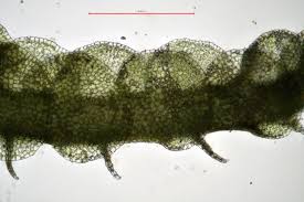 Attēlu rezultāti vaicājumam “Nardia scalaris cells”