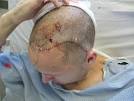 AMA investigation reveals brain surgery not all that hard after ...