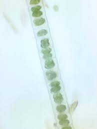 Attēlu rezultāti vaicājumam “Lycogala alisaulianovae young”