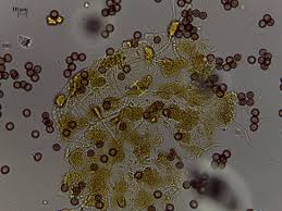 Attēlu rezultāti vaicājumam “Physarum viride var. aurantium”