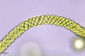 Attēlu rezultāti vaicājumam “Oligonema persimile macro”