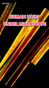 Image result for human hair microscope image